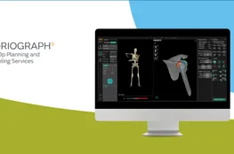 CORIOGRAPH Pre-Op Planning & Modeling Services - Smith+Nehew